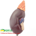 SELL 12433 Life Size Normal Kidney Anatomy Model, Anatomy Urinary Kidney Model